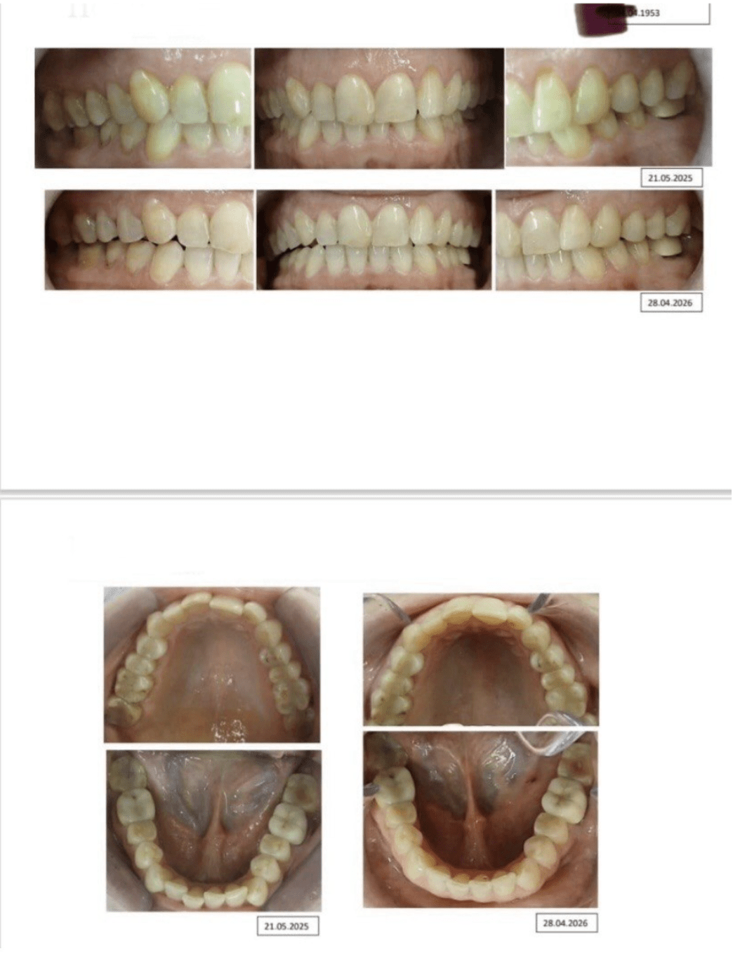Dentosophie – Vorher Nachher Transformation